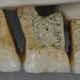 Five upper teeth of the newly described human species, Homo luzonensis.